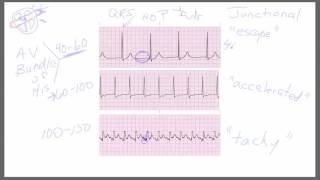 Junctional Rhythms [upl. by Nebuer702]