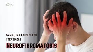 Neurofibromatosis Types Symptoms Causes and Treatment [upl. by Atinram877]