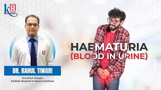 What is Hematuria Is blood in urine a serious condition  Kailash Hospital Sector 71 Noida [upl. by Neggem]