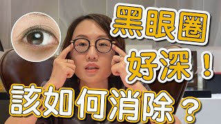 大家常常在問的黑眼圈可以怎麼治療？讓莊盈彥醫師來告訴你！ [upl. by Imak627]