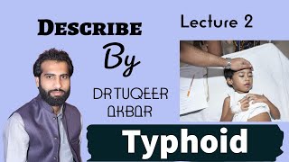 Typhoid Fever Treatment  Symptoms Diagnostic Tests Vaccine Medicine Lecture DR TUQEER AKBAR [upl. by Ebert313]