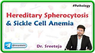 6 Hereditary spherocytosis amp Sickle Cell Anemia  USMLE Step 1 Pathology [upl. by Epperson]