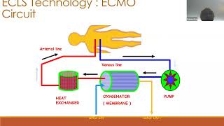 03 ECMO  Physiology by Dr Pranay Oza ECMO INDIA OCT 2024  Day 01 [upl. by Arolf]