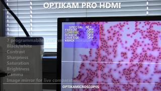 OPTIKAM PRO HDMI [upl. by Shirl]