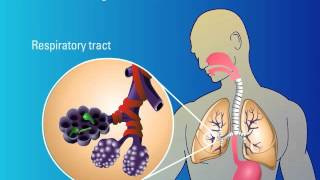 Recognition of Fungi and Activation of Immune Response [upl. by Deb]