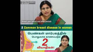 Fibroadenosis  Breast disease in women பெண்கள் மார்பகத்தில் பொதுவாக காணப்படும் 2 வியாதிகள் [upl. by Zweig464]