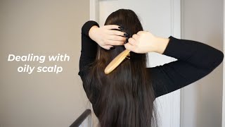 5 Tips for Oily Scalp ♡ [upl. by Ailaht]