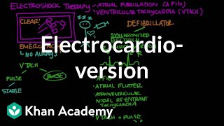 Electrocardioversion  Circulatory System and Disease  NCLEXRN  Khan Academy [upl. by Oribelle]