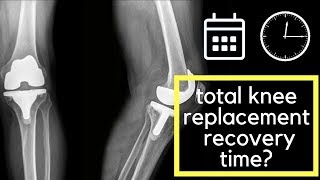 recovery time for total knee replacement [upl. by Okime]