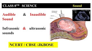 Audible and Inaudible sound  Infrasonic and ultrasonic sound  Class 8th and 9th  Chapter  Sound [upl. by Brown]