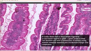 Histological transition from stomach to duodenum [upl. by Noraed]