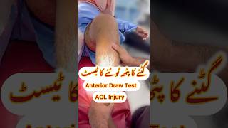 acl orthopedics sportsmedicine sportsinury orthocenter orthocare arthroscopicsurgery ortho [upl. by Sleinad]