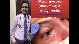 Mucormycosis definition and treatment according to ayurveda black fungus [upl. by Arihs86]