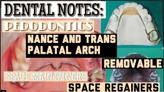 NANCE PALATAL ARCH II TRANS PALATAL ARCH II REMOVABLE SPACE MAINTAINERS II SPACE REGAINERS II easy [upl. by Acinod320]