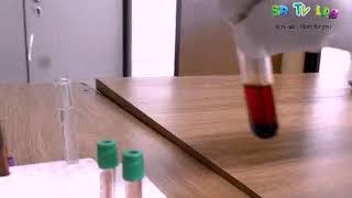 What is hemolysis hemolysis experiment using water [upl. by Ebocaj]