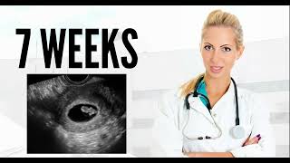 7 WEEKS ULTRASOUND 7 weeks pregnant ultrasound pregnancy ultrasound [upl. by Zuckerman895]