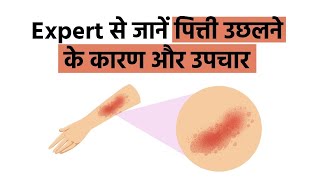 Urticaria पित्ती शीतपित्त उछलने के कारण और ऐसा होने पर कौन सी दवा लेनी चाहिए  Hives Treatment [upl. by Moretta19]