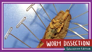 Worm Dissection  What are Worms Hiding Underneath Their Skin EDU [upl. by Aerised]