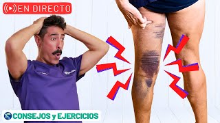 🔴 Mi experiencia con Roturas musculares  ejercicios y consejos 🔴 V [upl. by Beaver]