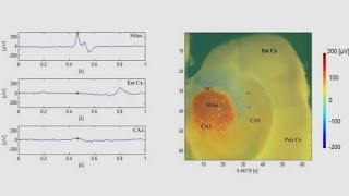 Propagating epileptiform activity in mouse corticohippocampal slices [upl. by Aihsiyt56]