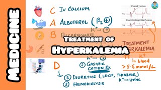 Treating Hyperkalemia usmle firstaid for inicet nclex neetpg with mnemonic [upl. by Latsryc]