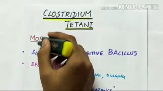 clostridium tetani  microbiology  handwritten notes [upl. by Eilagam]