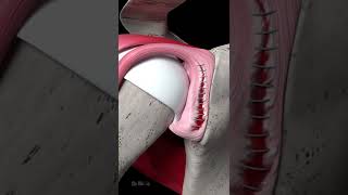 Shoulder Labrum Tear Repair Animation [upl. by Mikel863]