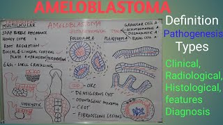 Ameloblastoma  Definition pathogenesis types clinical radiological features and diagnosis [upl. by Cly]