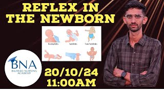 REFLEXES IN THE NEWBORNENEWBORNE REFLEXMORO REFLEXSUCKINGROOTINGBY SATARAM SIR [upl. by Lilly]