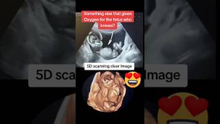 Fetus vs baby development in mothers womb ultrasound🥰🥰viralvideo trending viralshorts [upl. by Anneehs]