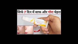 Melacare Cream Review in Hindi मेलाकेयर क्रीम के फायदे नुकसान उपयोग [upl. by Siravat794]