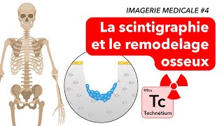 IMAGERIE MEDICALE 4  La scintigraphie et le remodelage osseux [upl. by Euqcaj]