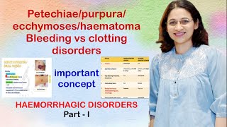 Petechiaepurpuraecchymoseshaematoma Clinical presentation of vesselplateletclotting disorders [upl. by Ailat421]