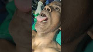 clinical demonstration of thyroglossal cyst [upl. by Nelloc]