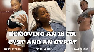 Finding out I HAD ENDOMETRIOSIS AND AN 18CM CYST in my Ovary Right ovary gets removed [upl. by Lela]