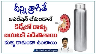 Kidney Stones VS Gallbladder Stones  How to Reduce Kidney Stones  Dr Ravikanth Kongara [upl. by Liscomb621]