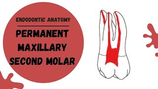 Endodontic Anatomy of the Permanent Maxillary Second Molar  Root canal anatomy [upl. by Ahseka]