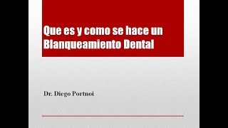 Blanqueamiento Dental  Que es y como se hace [upl. by Schlessel]