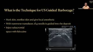 How To Treat Calcific Rotator Cuff Tendinopathy Ultrasound Guided Barbotage and PRP Injection [upl. by Ciprian107]