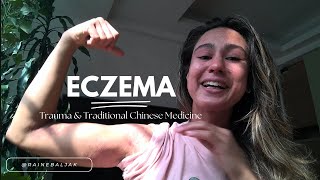 Eczema Trauma amp Traditional Chinese Medicine Week 5 in Taiwan [upl. by Zeiger]