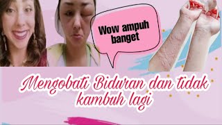 OBAT BIDURAN PALING AMPUH dan MURAH [upl. by Cindi987]