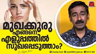 മുഖക്കുരു Acne Pimples എങ്ങനെ എളുപ്പത്തിൽ സുഖപ്പെടുത്താം [upl. by Leith]