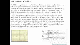 Understanding EEG Part 6Machine used in EEG diagnostic application signal recorded clinical use [upl. by Ttreve]