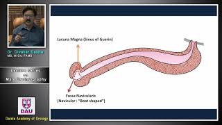 Lecture 3 on male urethrography [upl. by Notsruht]