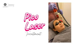 Pico Laser Treatment [upl. by Thar]