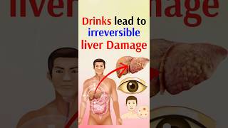 Drinks lead to irreversible liver damage [upl. by Assiram]