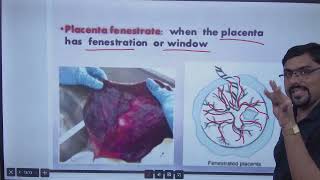 ABNORMALITIES OF PLACENTA AND CORD [upl. by Klara]