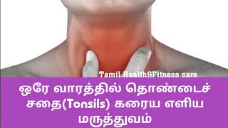 தொண்டைச் சதை கரைய எளிய மருத்துவம்  Tonsils treatment home remedies in tamil [upl. by Schoof]