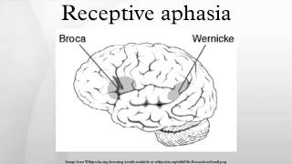 Receptive aphasia [upl. by Troth265]