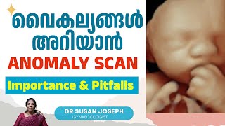 വൈകല്യങ്ങൾ 100 അറിയാൻ പറ്റുമോ അനോമലി സ്കാനിൽ  DRSUSAN JOSEPH [upl. by Trebmal]